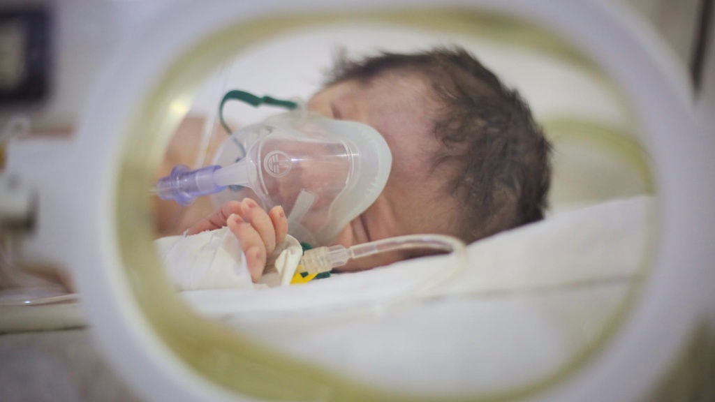 Больницам Екатеринбурга поставят новые аппараты искусственной вентиляции лёгких для младенцев